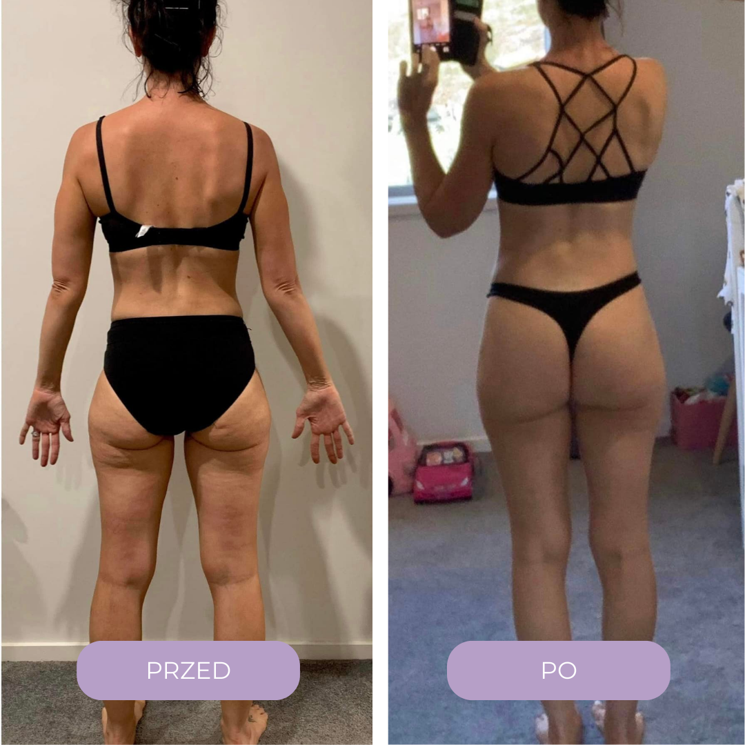 Masażer antycellulitowy Cuddlié